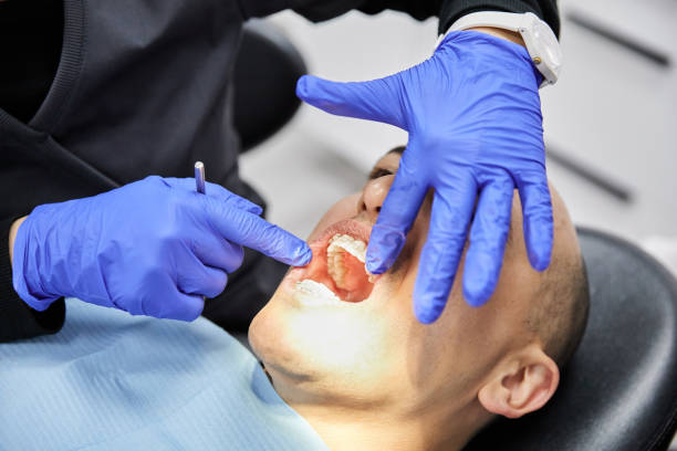 Best Emergency Tooth Extraction in Krugerville, TX