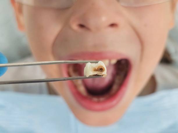 Best Emergency Dental Care for Trauma or Injury in Krugerville, TX